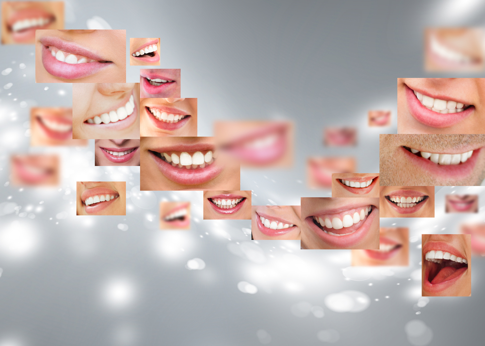 Trend In Instagram Teeth Whitening Products Causing MAJOR Damage to Teen Teeth